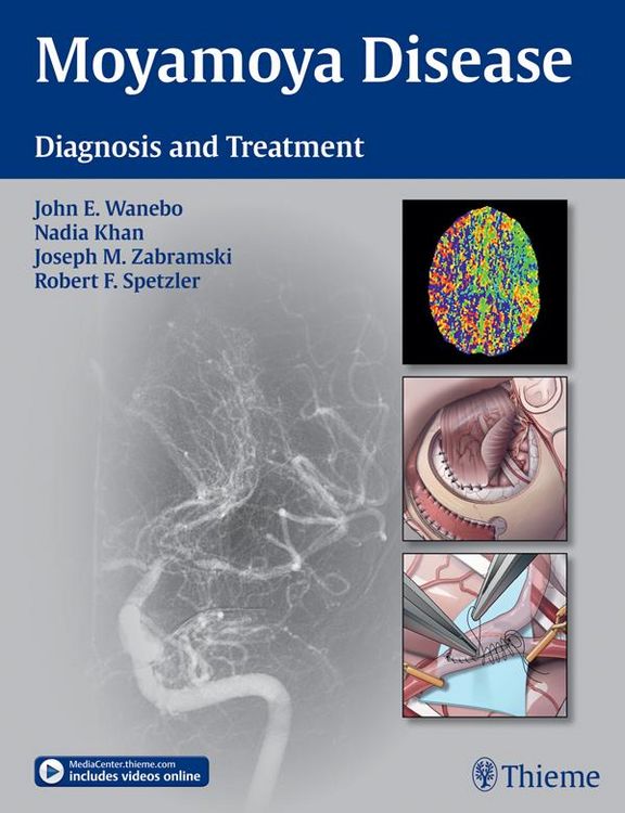 Produktbild: Moyamoya Disease