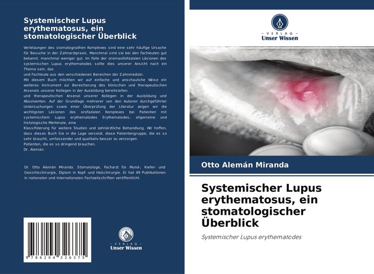 Produktbild: Systemischer Lupus erythematosus, ein stomatologischer &Uuml;berblick