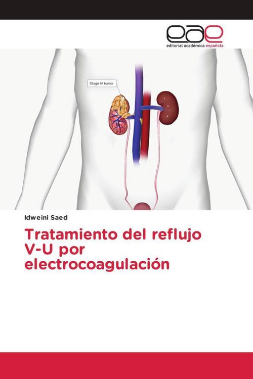 Produktbild: Tratamiento del reflujo V-U por electrocoagulaci&oacute;n
