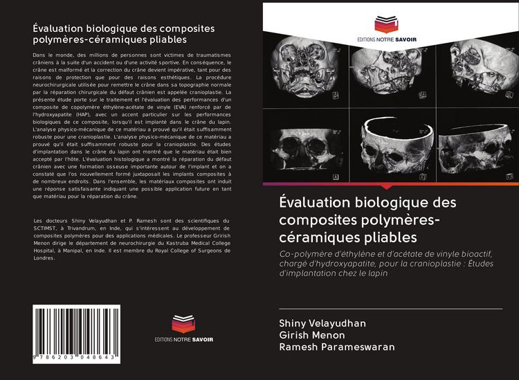 Produktbild: &Eacute;valuation biologique des composites polym&egrave;res-c&eacute;ramiques pliables