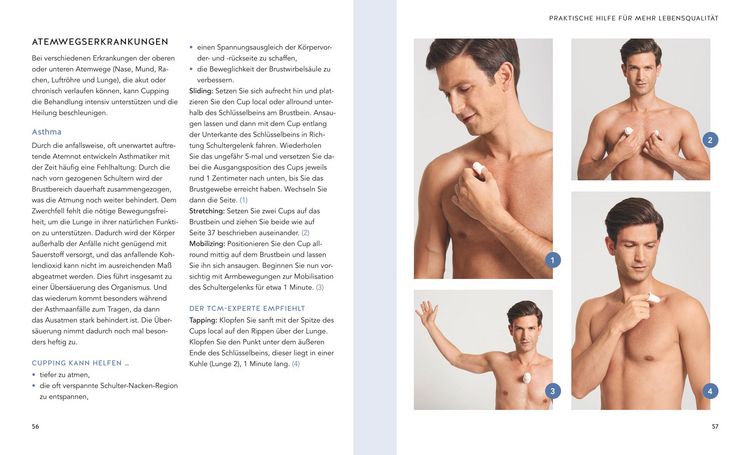 Produktbild: Cupping - Die neue Methode zum L&ouml;sen der Faszien