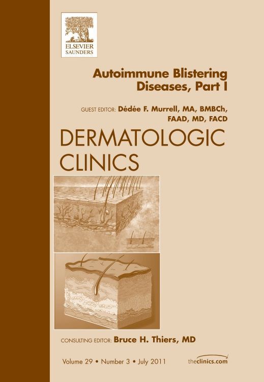 Produktbild: Autoimmune Blistering Disease Part I, an Issue of Dermatologic Clinics