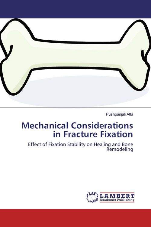 Produktbild: Mechanical Considerations in Fracture Fixation