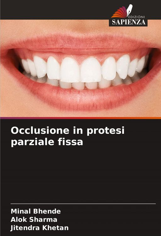 Produktbild: Occlusione in protesi parziale fissa