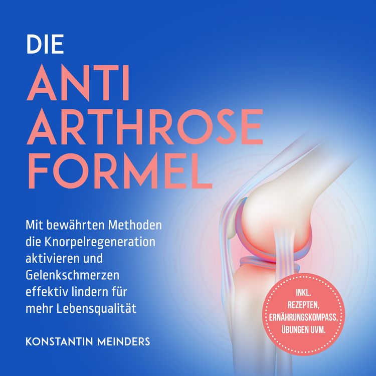 Produktbild: Die Anti Arthrose Formel: Mit bew&auml;hrten Methoden die Knorpelregeneration aktivieren und Gelenkschmerzen effektiv lindern f&uuml;r mehr Lebensqualit&auml;t - inkl. Rezepten, Ern&auml;hrungskompass, &Uuml;bungen uvm.