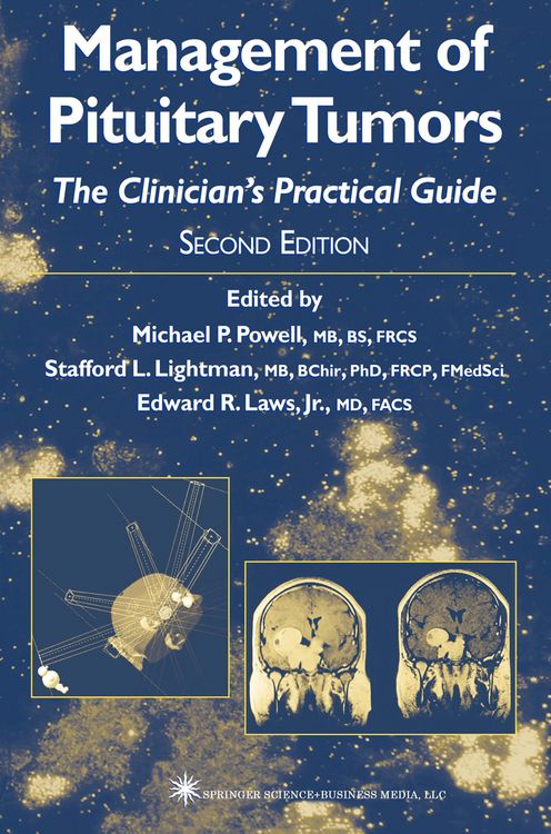 Produktbild: Management of Pituitary Tumors