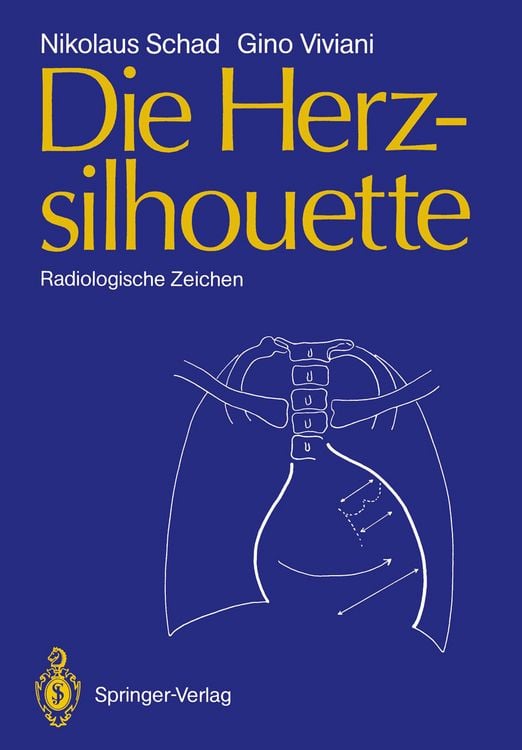 Produktbild: Die Herzsilhouette