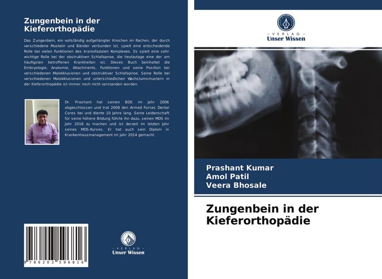 Produktbild: Zungenbein in der Kieferorthop&auml;die