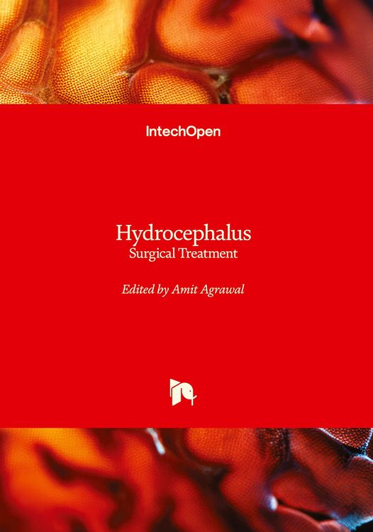 Produktbild: Hydrocephalus - Surgical Treatment