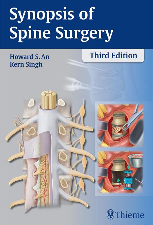 Produktbild: Synopsis of Spine Surgery