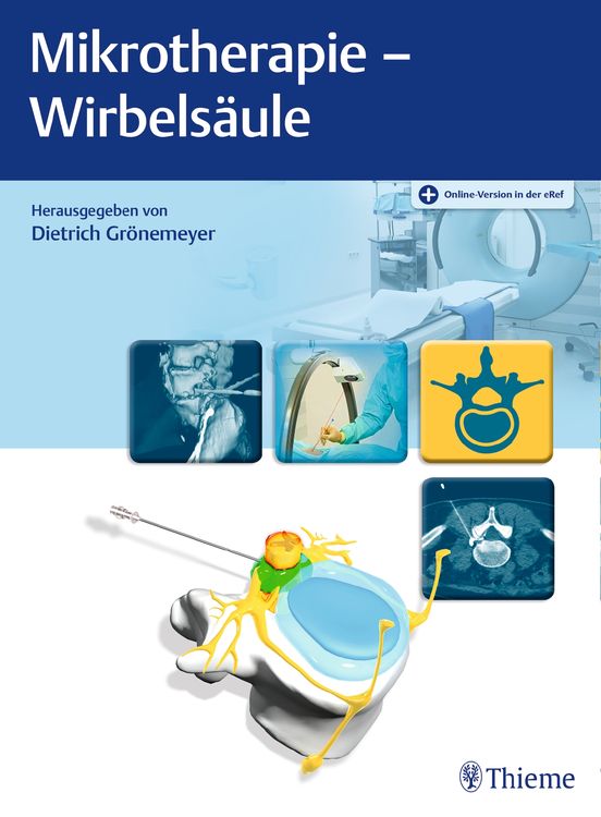 Produktbild: Mikrotherapie - Wirbels&auml;ule