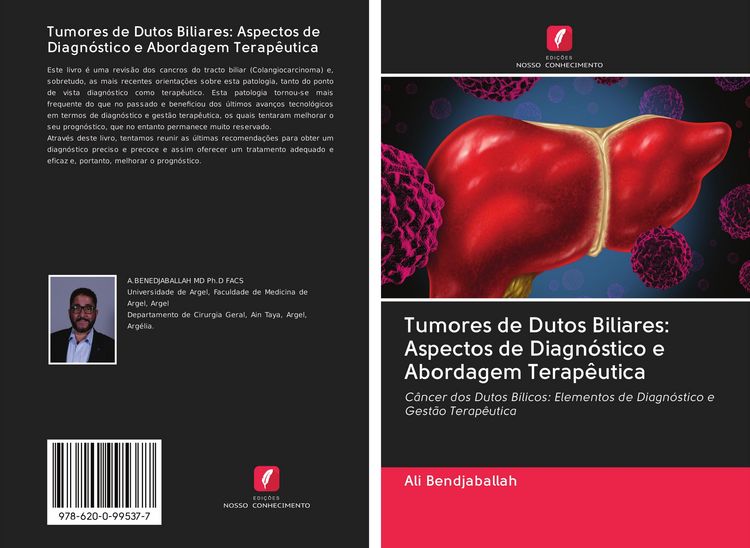 Produktbild: Tumores de Dutos Biliares: Aspectos de Diagn&oacute;stico e Abordagem Terap&ecirc;utica