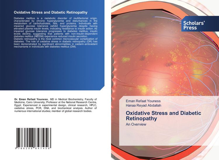 Produktbild: Oxidative Stress and Diabetic Retinopathy