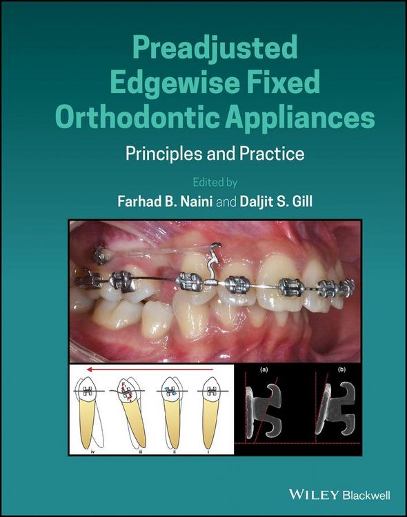 Produktbild: Preadjusted Edgewise Fixed Orthodontic Appliances