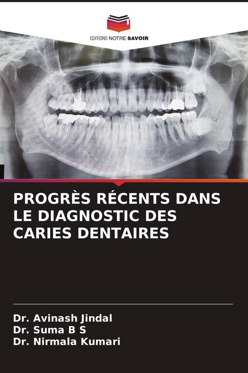Produktbild: Progr&egrave;s R&eacute;cents Dans Le Diagnostic des Caries Dentaires