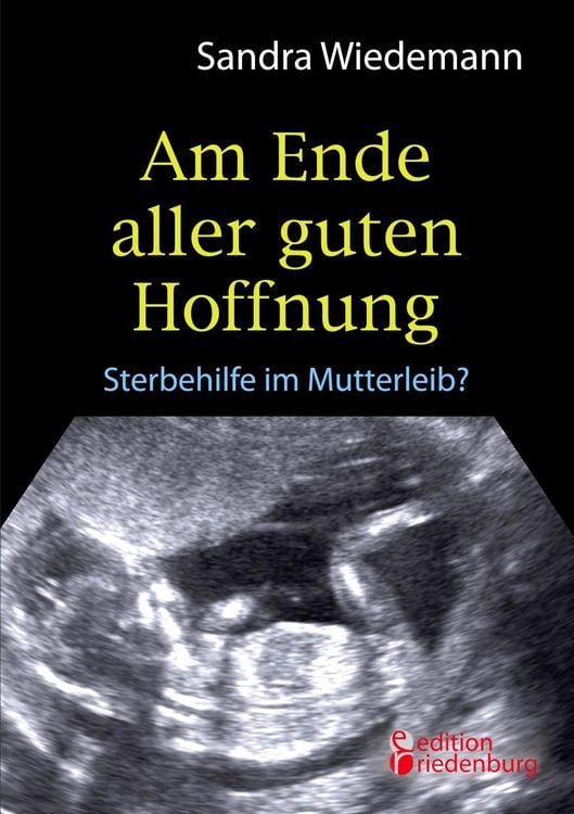 Produktbild: Am Ende aller guten Hoffnung - Sterbehilfe im Mutterleib?