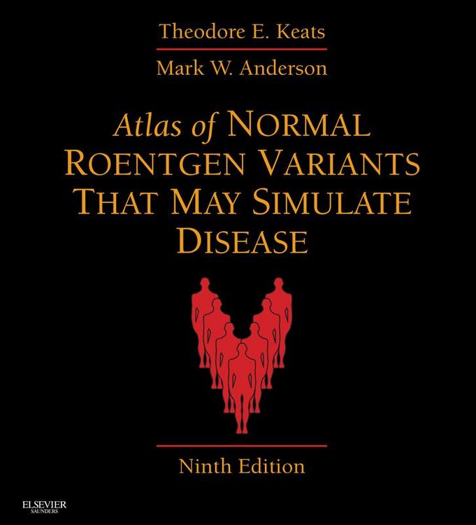 Produktbild: Atlas of Normal Roentgen Variants That May Simulate Disease E-Book