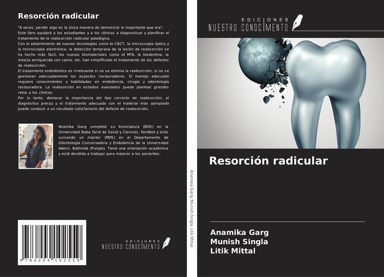 Produktbild: Resorci&oacute;n radicular