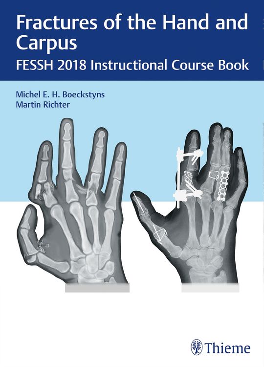 Produktbild: Fractures of the Hand and Carpus