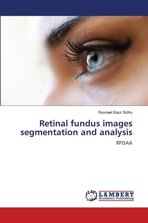 Produktbild: Retinal fundus images segmentation and analysis