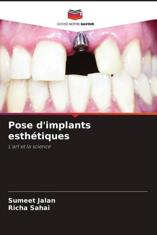 Produktbild: Pose d'implants esth&eacute;tiques