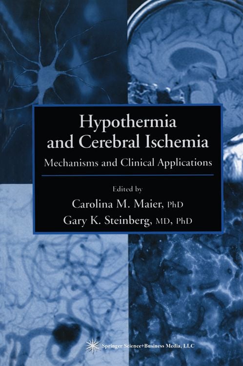 Produktbild: Hypothermia and Cerebral Ischemia