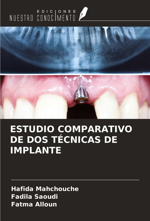 Produktbild: Estudio Comparativo De Dos T&eacute;cnicas De Implante