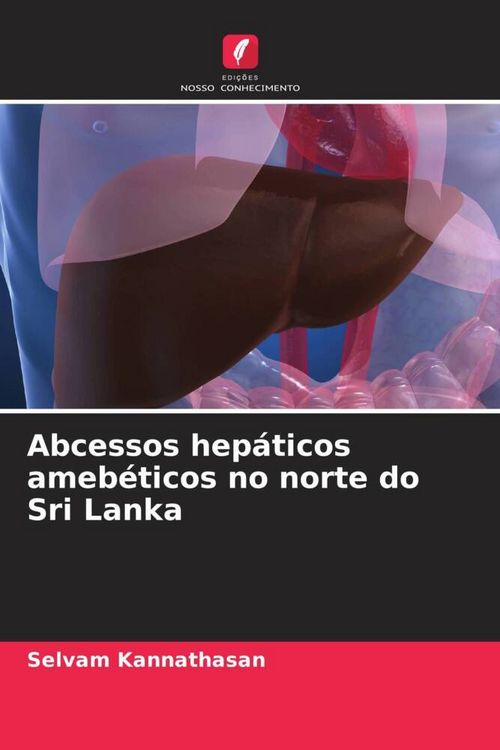 Produktbild: Abcessos hep&aacute;ticos ameb&eacute;ticos no norte do Sri Lanka