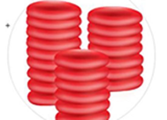 Produktbild: Erythrocyte Sedimentation Rate (ESR)