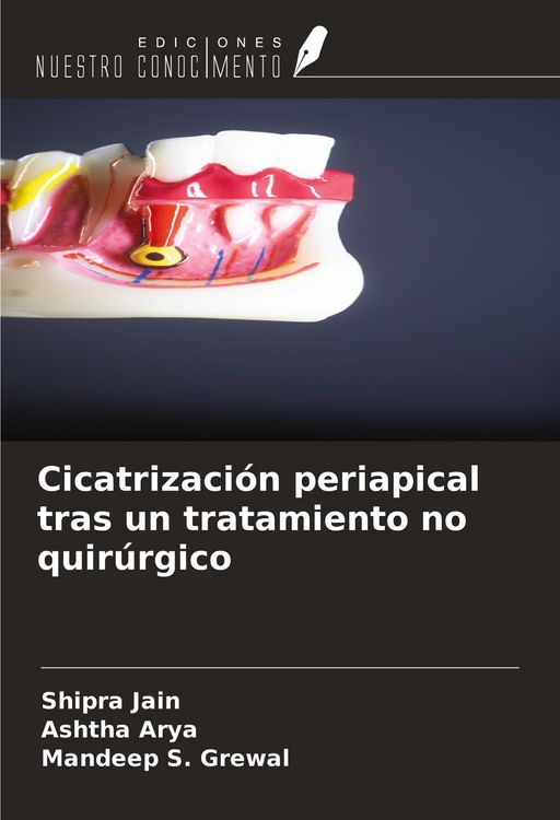 Produktbild: Cicatrizaci&oacute;n periapical tras un tratamiento no quir&uacute;rgico
