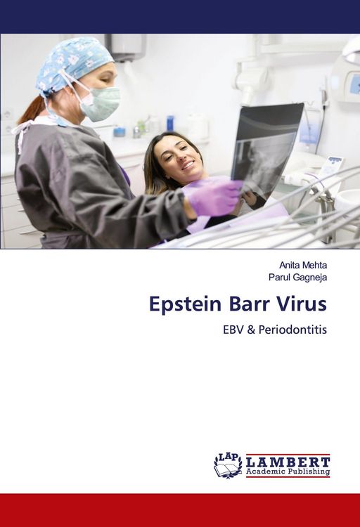 Produktbild: Epstein Barr Virus