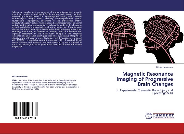 Produktbild: Magnetic Resonance Imaging of Progressive Brain Changes