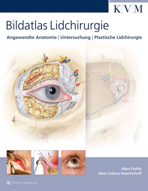 Produktbild: Bildatlas Lidchirurgie