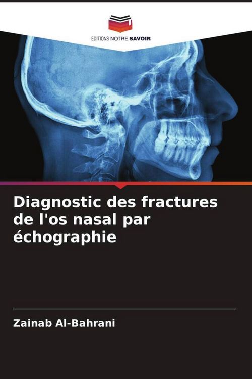 Produktbild: Diagnostic des fractures de l'os nasal par &eacute;chographie