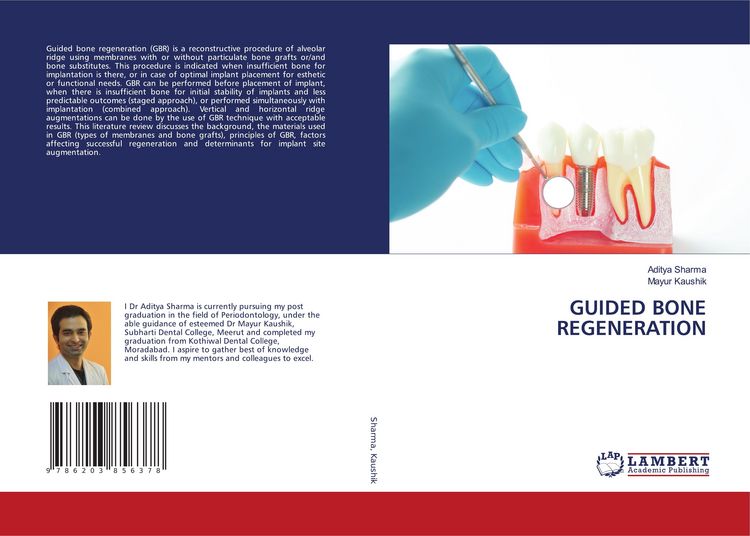 Produktbild: Guided Bone Regeneration