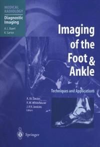 Produktbild: Imaging of the Foot & Ankle