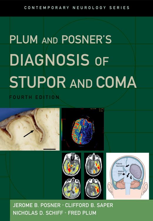 Produktbild: Plum and Posner's Diagnosis of Stupor and Coma
