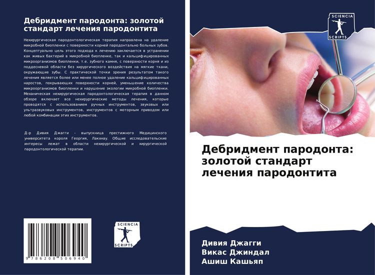 Produktbild: Debridment parodonta: zolotoj standart lecheniq parodontita