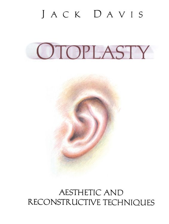 Produktbild: Otoplasty