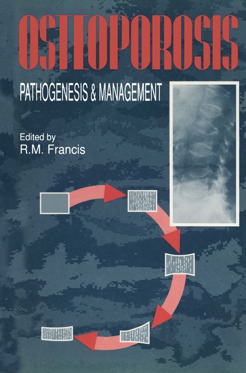 Produktbild: Osteoporosis