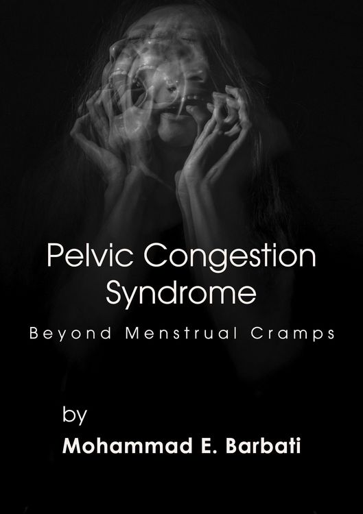 Produktbild: Pelvic Congestion Syndrome - Beyond Menstrual Cramps