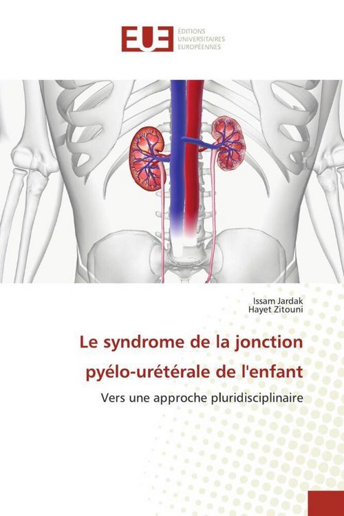 Produktbild: Le syndrome de la jonction py&eacute;lo-ur&eacute;t&eacute;rale de l'enfant