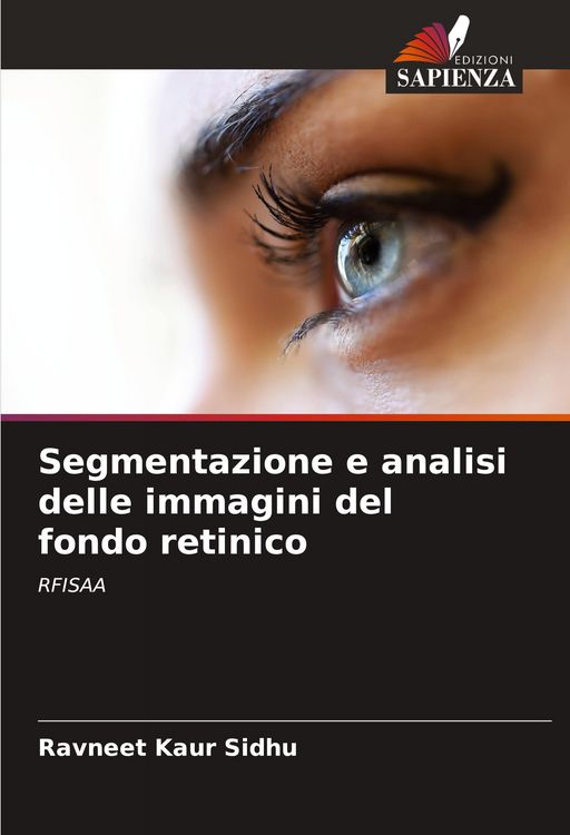 Produktbild: Segmentazione e analisi delle immagini del fondo retinico