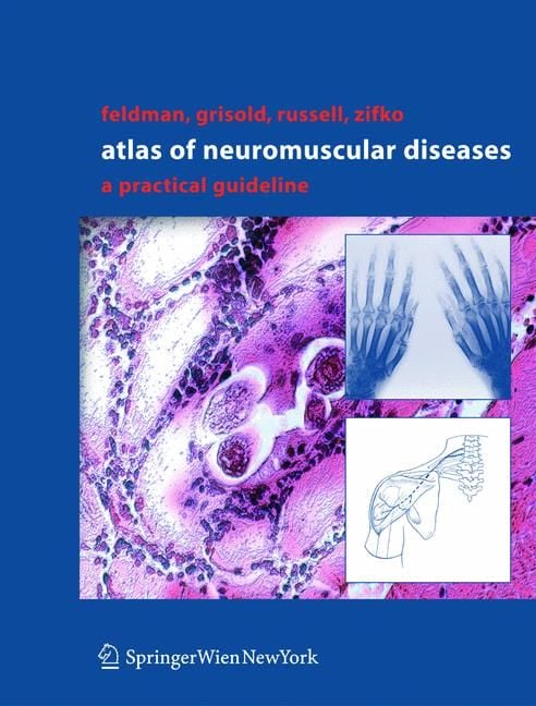 Produktbild: Atlas of Neuromuscular Diseases
