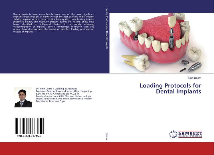 Produktbild: Loading Protocols for Dental Implants