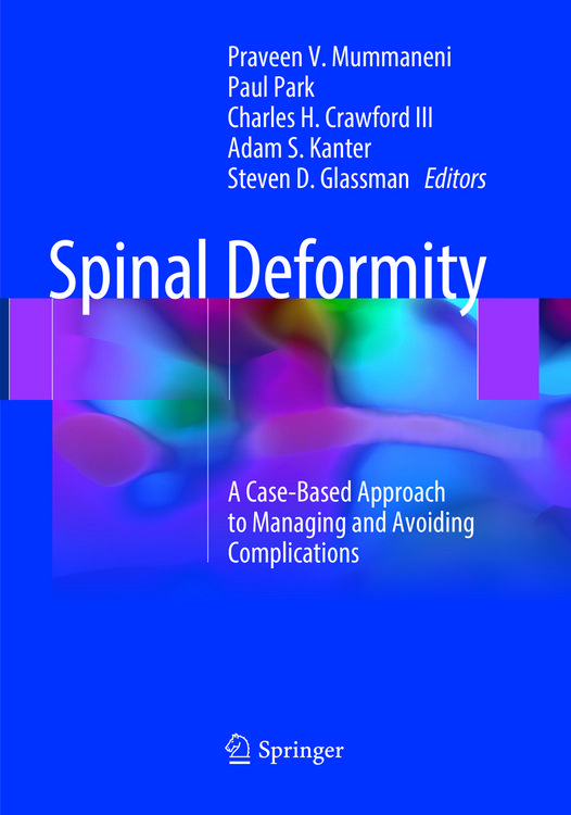 Produktbild: Spinal Deformity