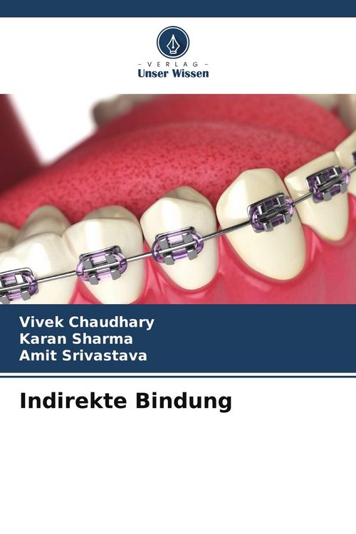 Produktbild: Indirekte Bindung