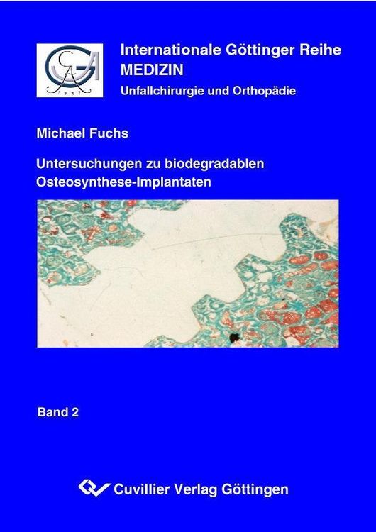 Produktbild: Untersuchungen zu biodegradablen Osteosynthese-Implantaten