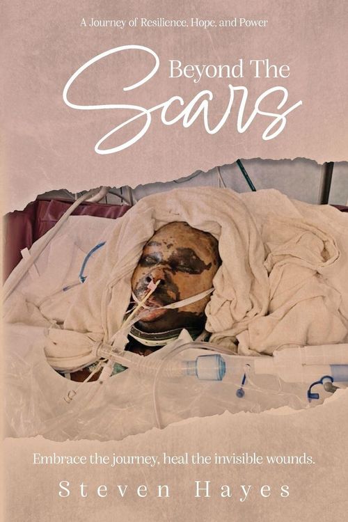 Produktbild: Beyond The Scars