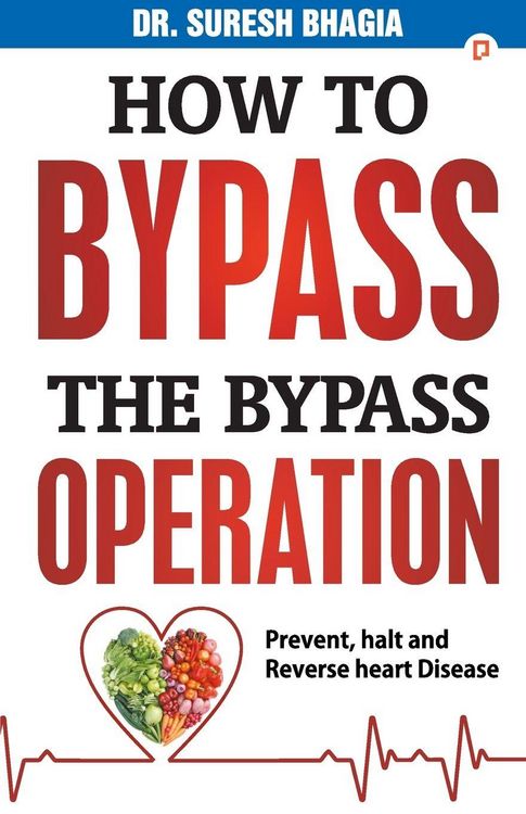 Produktbild: How to Bypass the Bypass Operation